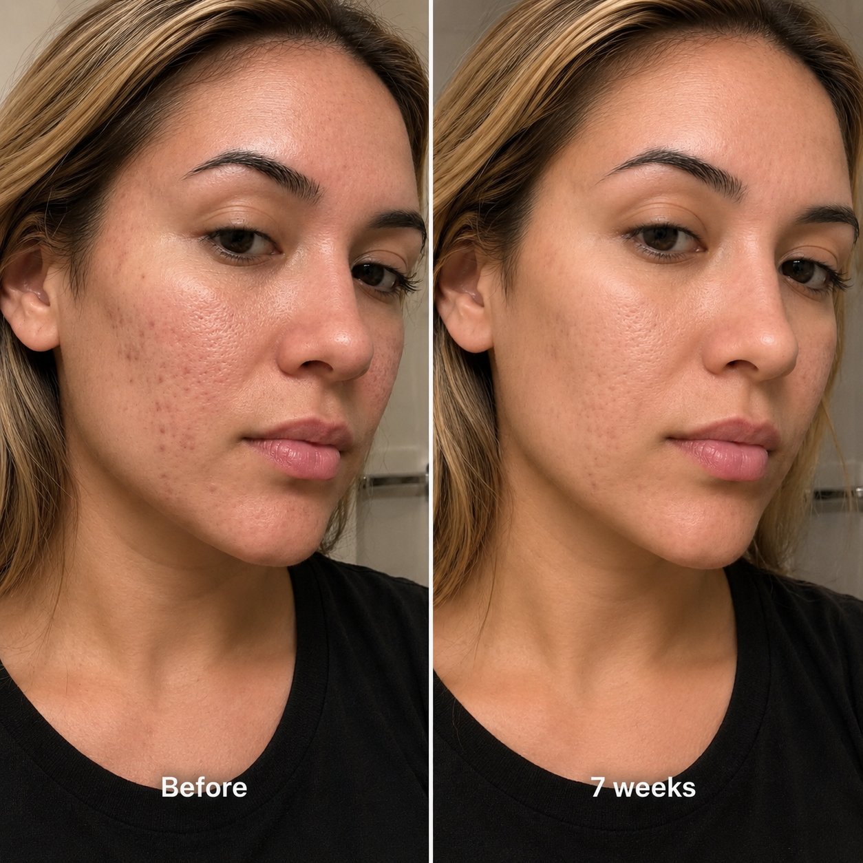 Clinical Acne Scar Repair Stick™